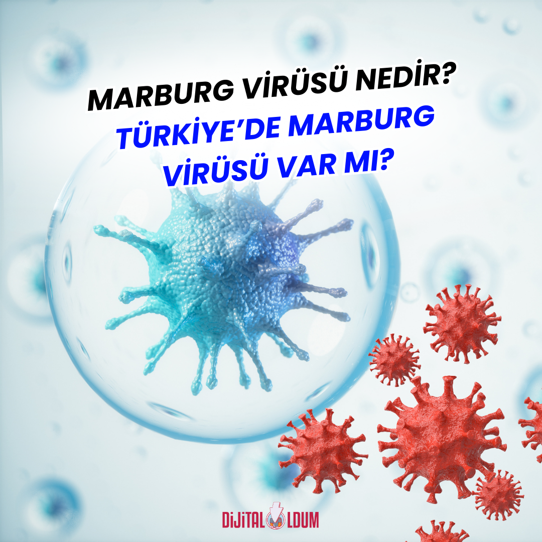 Marburg Virüsü Nedir? Türkiye’de Marburg Virüsü Var mı?